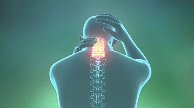 Dzemdes kakla reģiona osteohondroze