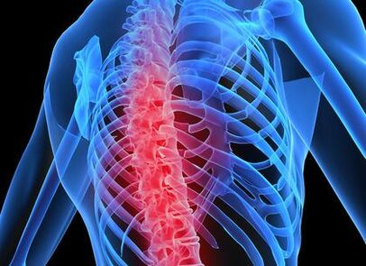 mugurkaula krūšu osteohondroze