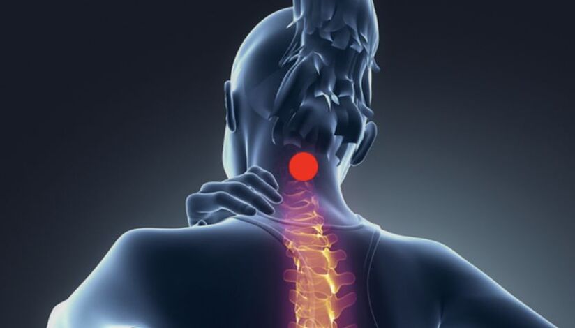 dzemdes kakla osteohondrozes simptomi