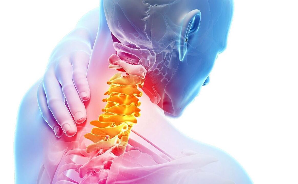 sāpes ar dzemdes kakla osteohondrozi